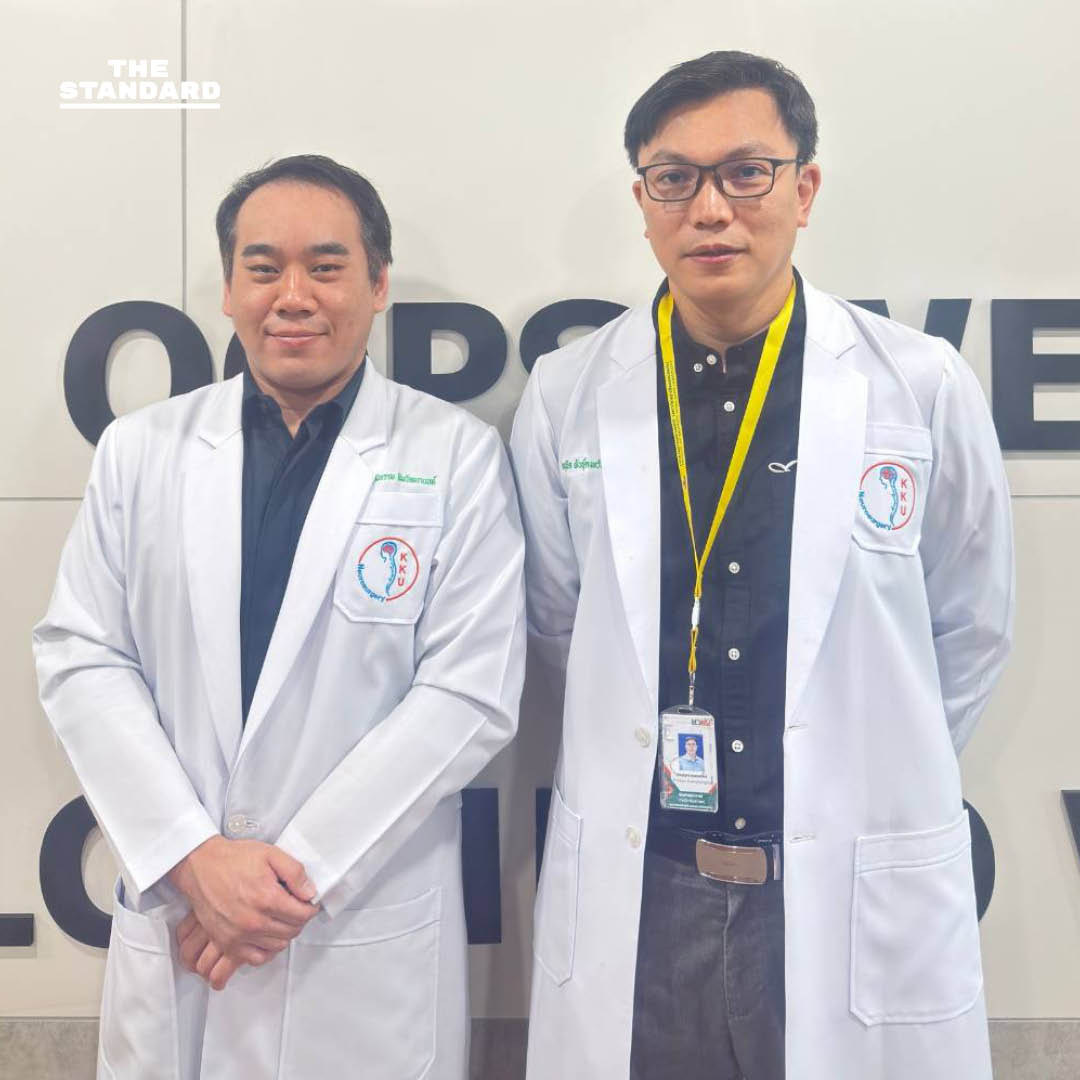 ทีมแพทย์ศรีนครินทร์ ‘มือกู้ระเบิดในสมอง’ กับภารกิจรักษา AVM ผ่านเทคนิคสายสวน